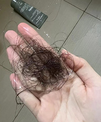换季掉头发这个量是正常的吗?求你们推荐真实好用的洗发水!