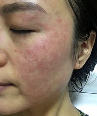 ��Ѫ�����������м�����ù��̵�С����