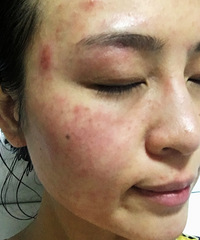 ��Ѫ�����������м�����ù��̵�С����