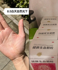 补气血这些方法真的有用,手掌颜色不再蜡黄