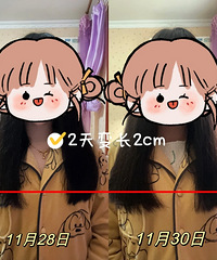 2��ͷ���䳤2cm�ķ������ˣ�����ͷ���䳤�ĸϽ�ѧϰ