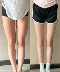 �ײⱦ�������̳̣����ȷ��⿨����