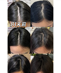 ����81�죬ͺͷŮ���Ŀ����ֻ�����