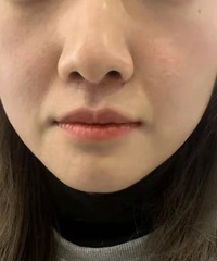 �ǻ��׷��������̫�����ˣ�������Ҷ�����ʲô��������İ�