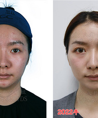 ����һ����Ӻ�ˮ�⣬�ҵĴ���Ƥ�Ͷ��������ڵþ��ˣ�