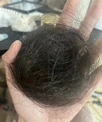 防脱发秘诀来了!全部都是亲测有效的好方法