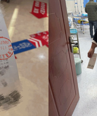 阳康后开始背痛、胸痛,来医院照片