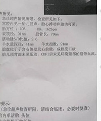 ԤԼ�ʸ�����ȴ���ٲ�ǰϦ�����¹ڣ�������������