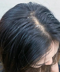 �����������һ��ͷƤ������ͷƤм��������������������κ�