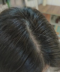 ˢ����ƪ��˵�����ͷ����Ҫû�ˣ��Ͻ�ѧ����