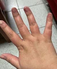 ��������160�����ָ�ı仯�ж��