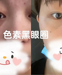 ���ٿ�Ǯ��������ҳ�������ĺ���Ȧ�������˿����������˲���