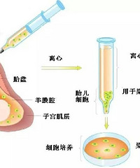 ��ɸ���޴�������ôѡ������ƪ�������