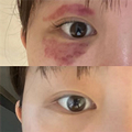 黑眼圈是真没了呀