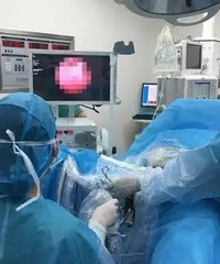 �������������������ǻ�ڷ����в���̥����֯