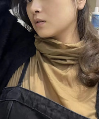 做超声炮一个月后的效果,惊艳到了我的所有朋友