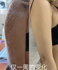 超厉害的瘦手臂运动!练一周就能看见明显的变化