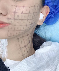 热玛吉是一场烫脸酷刑吗?真正做过的姐妹来反馈