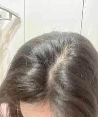 坚持了半年,我稀疏的发缝就变得很茂密了