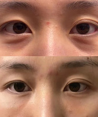 �ֲ����������ṵ�ķ�ʽ���ð�