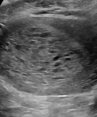 ���а���������ܣ��ӹ��ڲ�����̥������