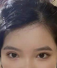 割双眼皮是一种怎样的体验,给大家分享我的经历