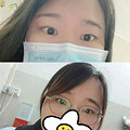 视力变好,眼睛变大了