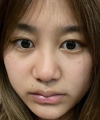 关于我去隆鼻想变美的事