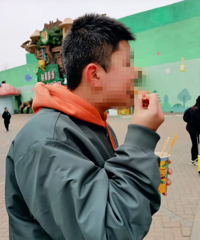 13岁的娃头发花白,白头发数量几乎占4成,你们遇到过这种情况吗