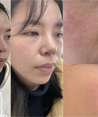 三文鱼水光你听说过吗?嫩肤效果好棒
