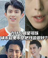 为什么明星可以很快把牙齿做好?答案就在帖子里