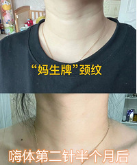 ����Ҫ������������ˣ��ײ���100�޾���˪��û����Ч����