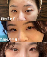 �ṵ��伴��Ч���ͺ����԰�������˲������5��~