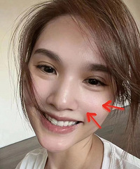 ������ô�����İ�����38����Ƥ��״̬����ô�ã���������