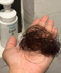 最近有没有疯狂掉头发的姐妹?