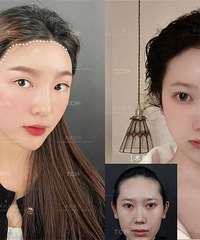 【征集直播帖模特】免费体验不剃发植发技术!轻松长出发际线