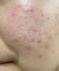 �����۷�+ˢ���5�죡ԭ��������Աȣ���Ȼ�Ҳ����տ���