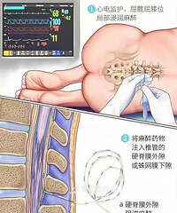 ���꺢����ʹ�����������ǵĻ���