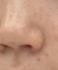 姐妹们你们用过最有效的美白精华是什么