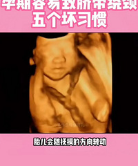 ע���ˣ���������ƾ��ļ���ϰ�ߣ�����һ��Ҫ���⣡