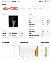 儿童测试骨龄有必要吗?儿子测出来还没有他爹高