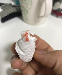 搬新家一周,睡了觉起来嘴皮发木,鼻子不舒服,还有鼻血