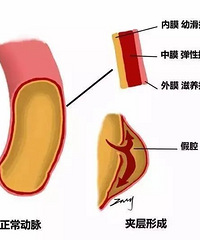 ���գ��и�ͻ���������в㣬�����ʽ������֮��