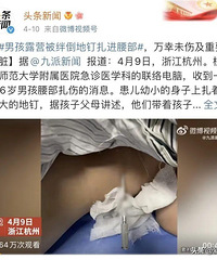 һ��û��ס���޾������ˣ��������޷�ʽ�������ȫ����Ҫע��