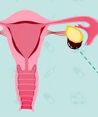 ��������ǻ��Ĳ���ɱ�֣������ⷢ������������