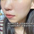 6次光子嫩肤经验总结