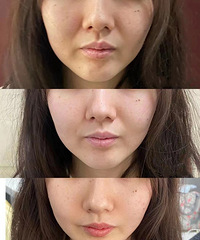 ����沿�٤С����ı仯���ϲ����ң�����������б䵭��