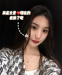 做了4次超皮秒,毫无保留的经验分享!想祛斑的看