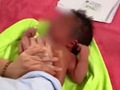 婴儿按摩后进ICU