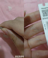 五一家里蹲,要上班了发现我阳了!